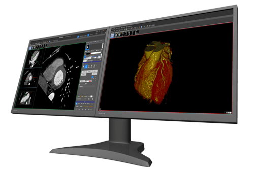 ART-Intuition-4.6-DualScreen-Cardiovascular.png
