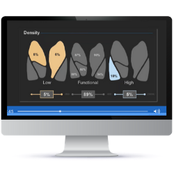 Drive Better Patient Care with Quantitative Lung CT Metrics in Clinical Chest CT Reporting Webinar Recording_VIDA_Resources Page_6.4.2020