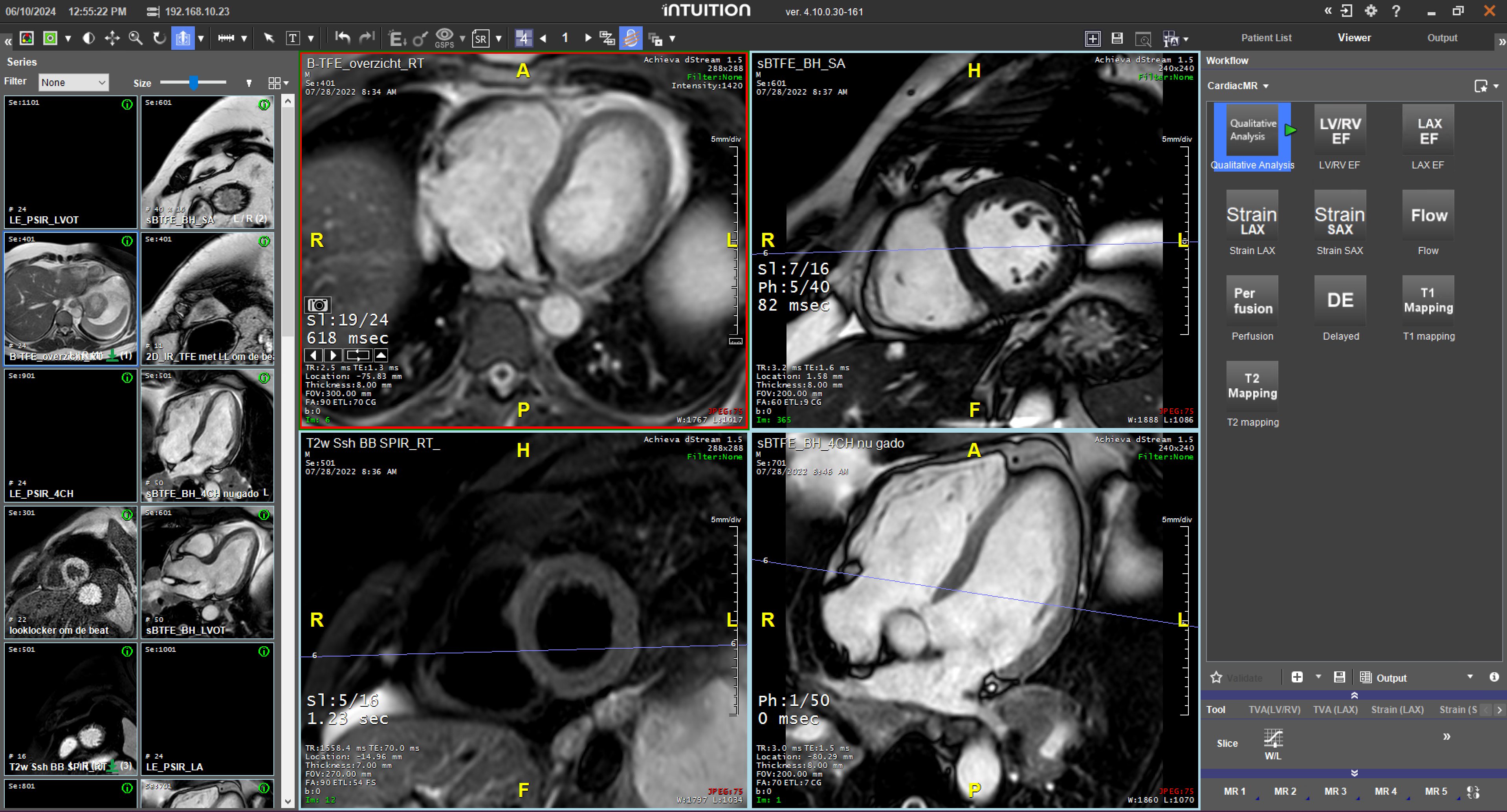 Intuition-4.10-image6