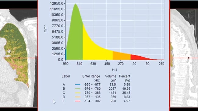 Labeling Volume Histogram_TeraRecon Intuition_Whats New P7