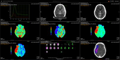 Stroke and Trauma ai medical imaging