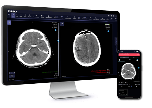 TeraRecon Neuro_ICH Desktop and Mobile