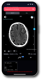 TeraRecon TR Neuro -Hero-Neuro-Mobile-ICH@4x