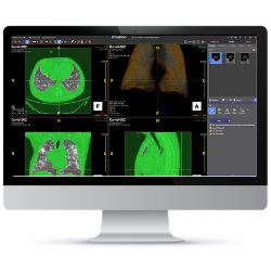 TeraRecon -Mission Critical Clinical Care AI-Driven Advanced Visualization for the Enterprise - RSNA Featured Demo (1)