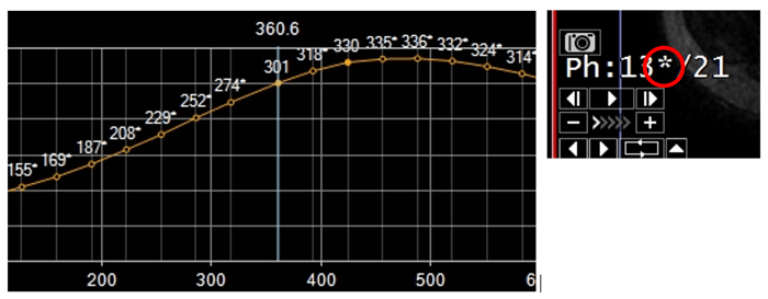 TeraRecon 4.4.13 (P4) Release MultiPhase Breast and Prostate Improvements 4,5