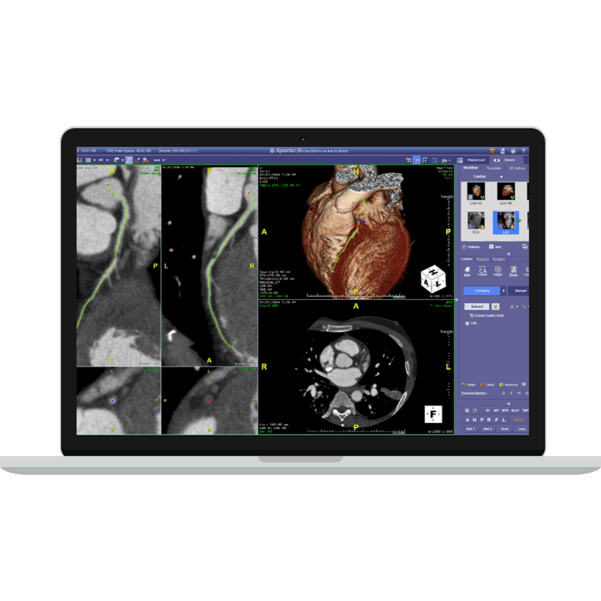 TeraRecon_Clinical Training Programs