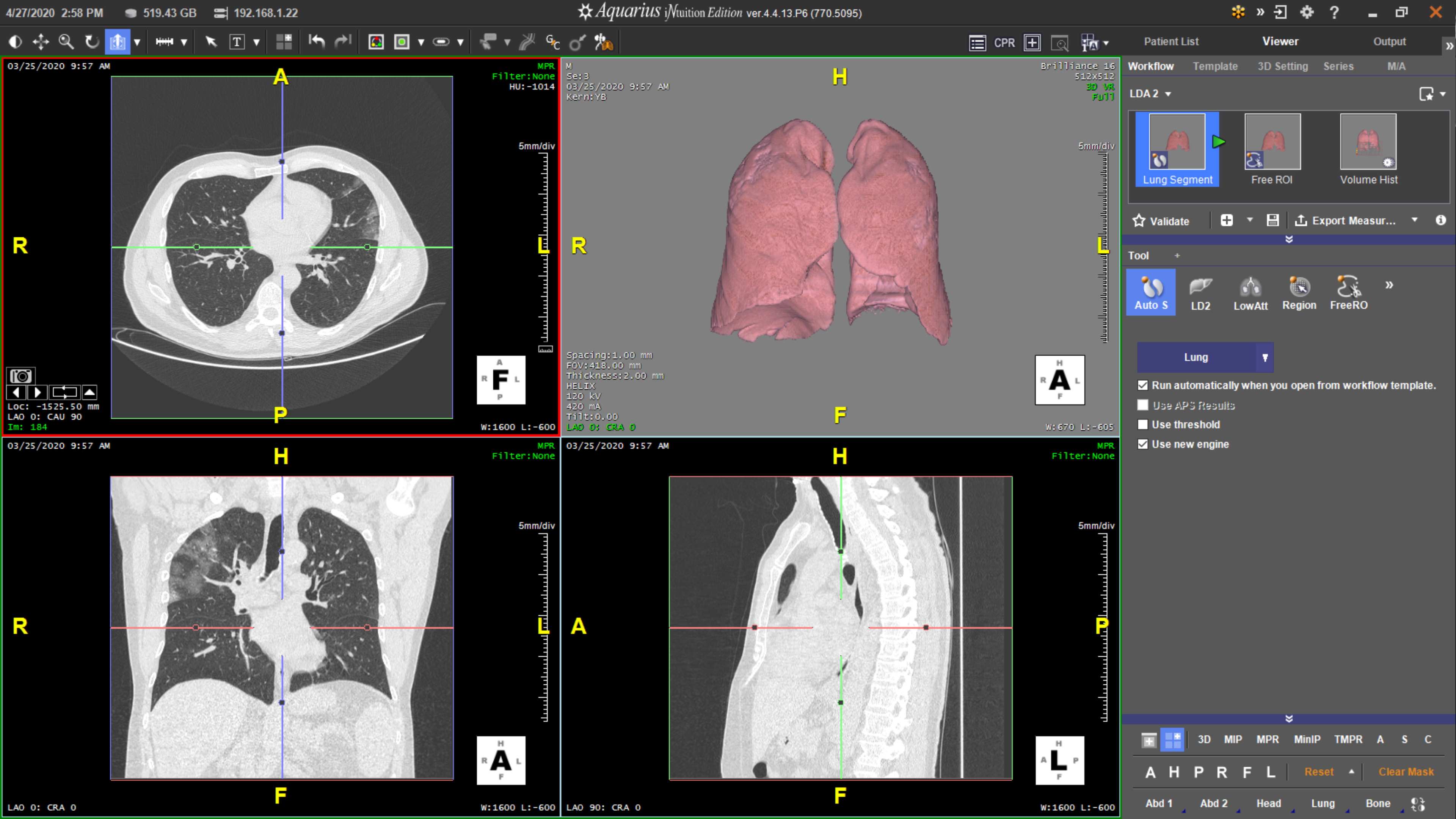 Lung Segmentation