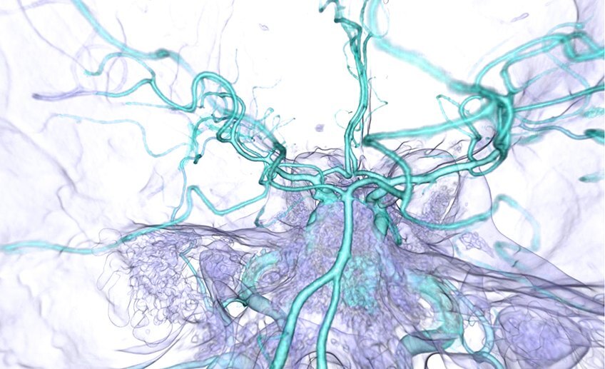 Rendering: Lungs, axial