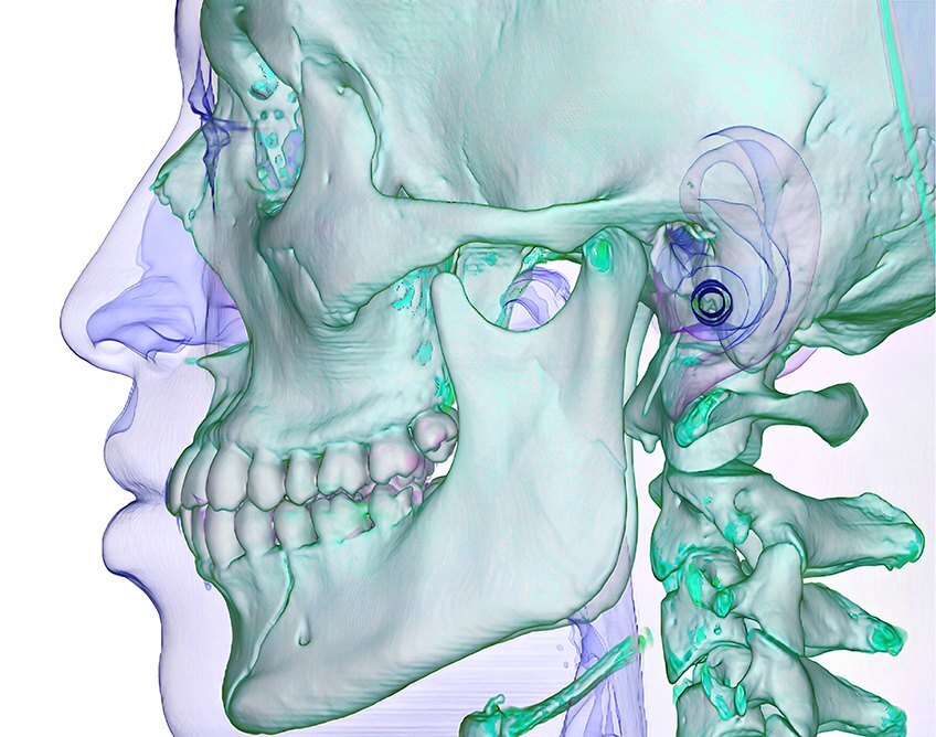 Rendering: Skull, side