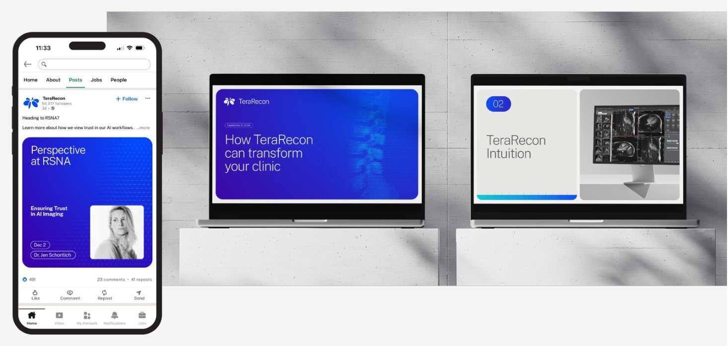 A LinkedIn post and two presentation slides