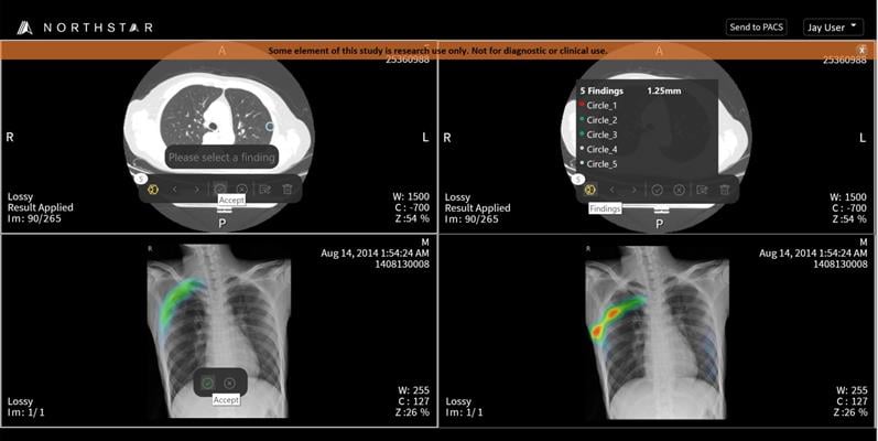 TeraRecon Spinoff EnvoyAI Named Best New Radiology Vendor in 2018 Minnies awards