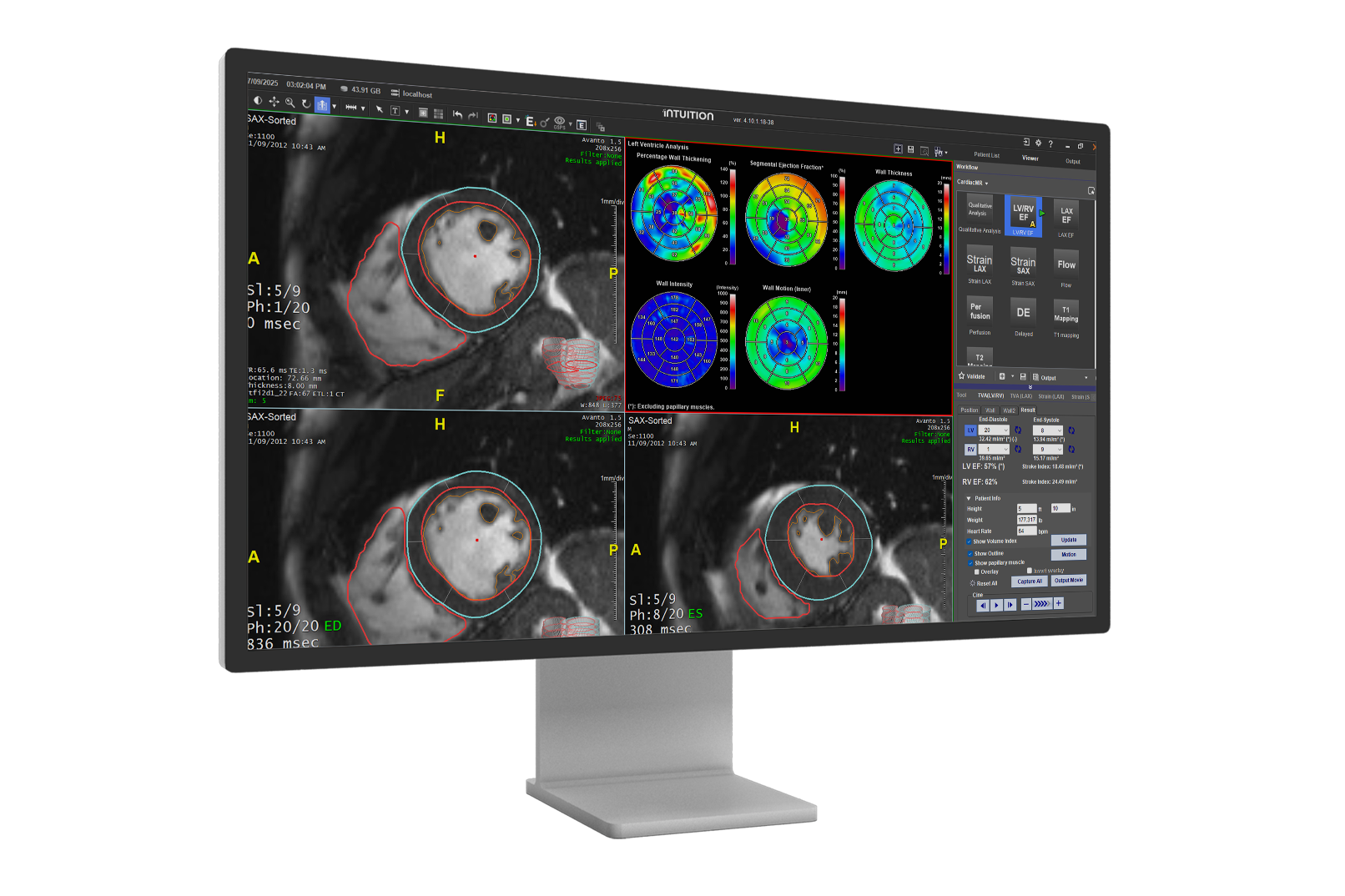 AV-Right-Monitor v2 (1)