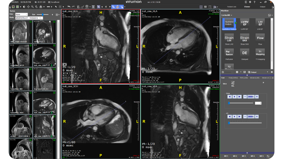 Advanced Workflows (NEW)