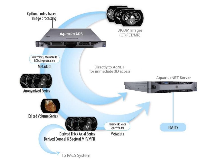 TeraRecon APS Pre-Processes Data for Efficiency Across the Enterprise