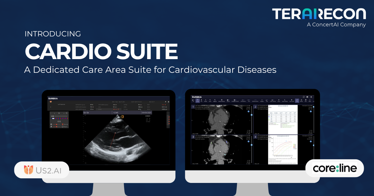 ConcertAI’s TeraRecon Adds Cardio Suite to its Eureka Clinical AI Platform