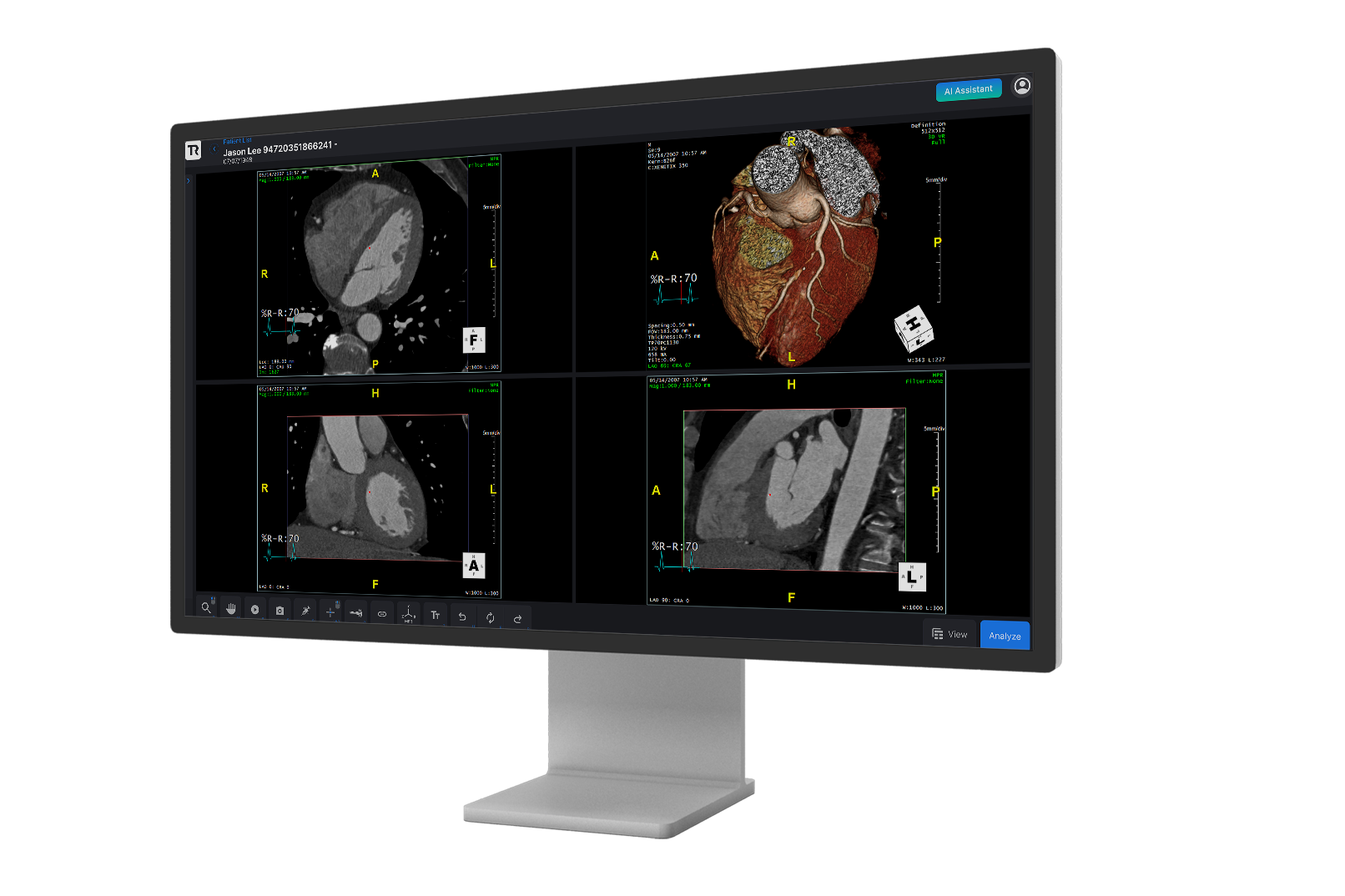 DETECT-Left-Monitor v2 (1)