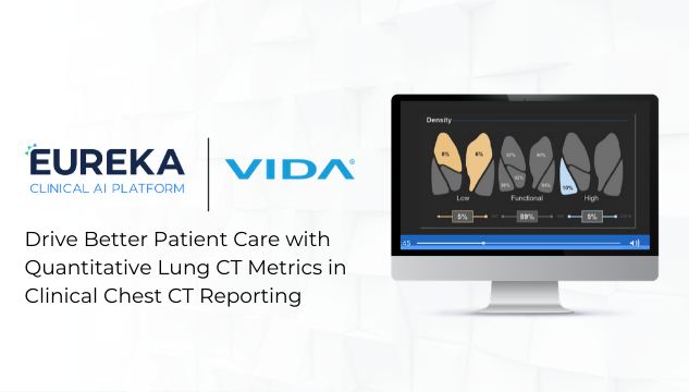 Drive Better Patient Care with Quantitative Lung CT Metrics in Clinical Chest CT Reporting_VIDA_Webinar Image_6.4.2020