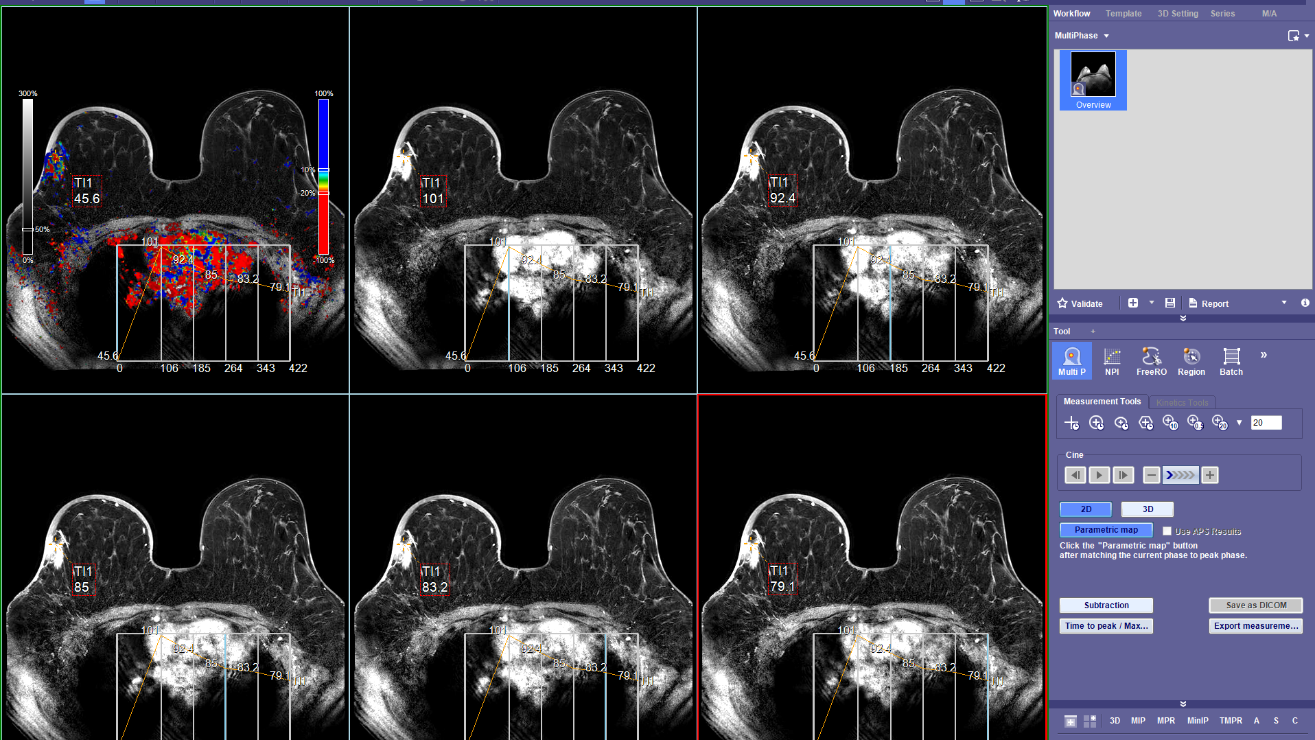 2D, 3D, 4D image sequencing-1-878295-edited