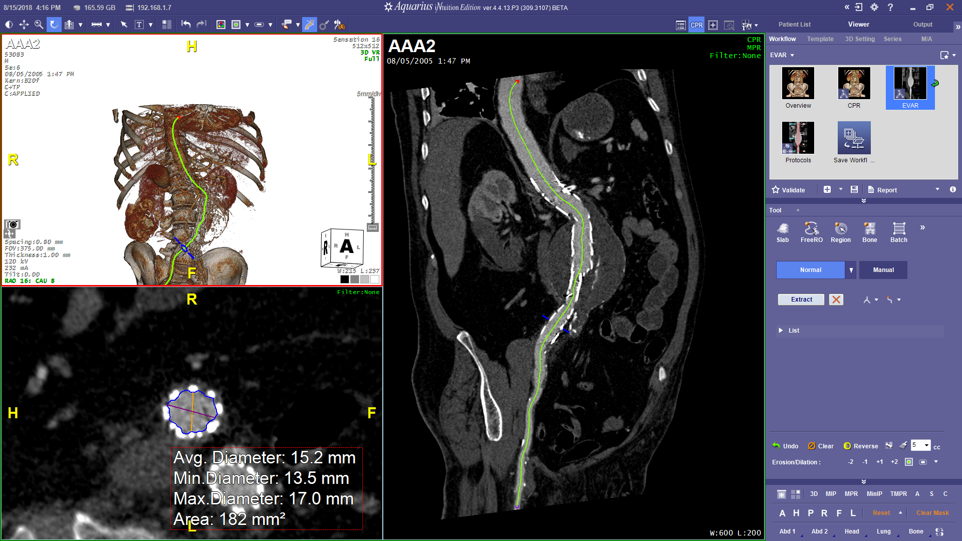 CPR and Axial Renderings