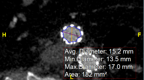 Diameter vs Distance and Cross-sectional Views-564362-edited