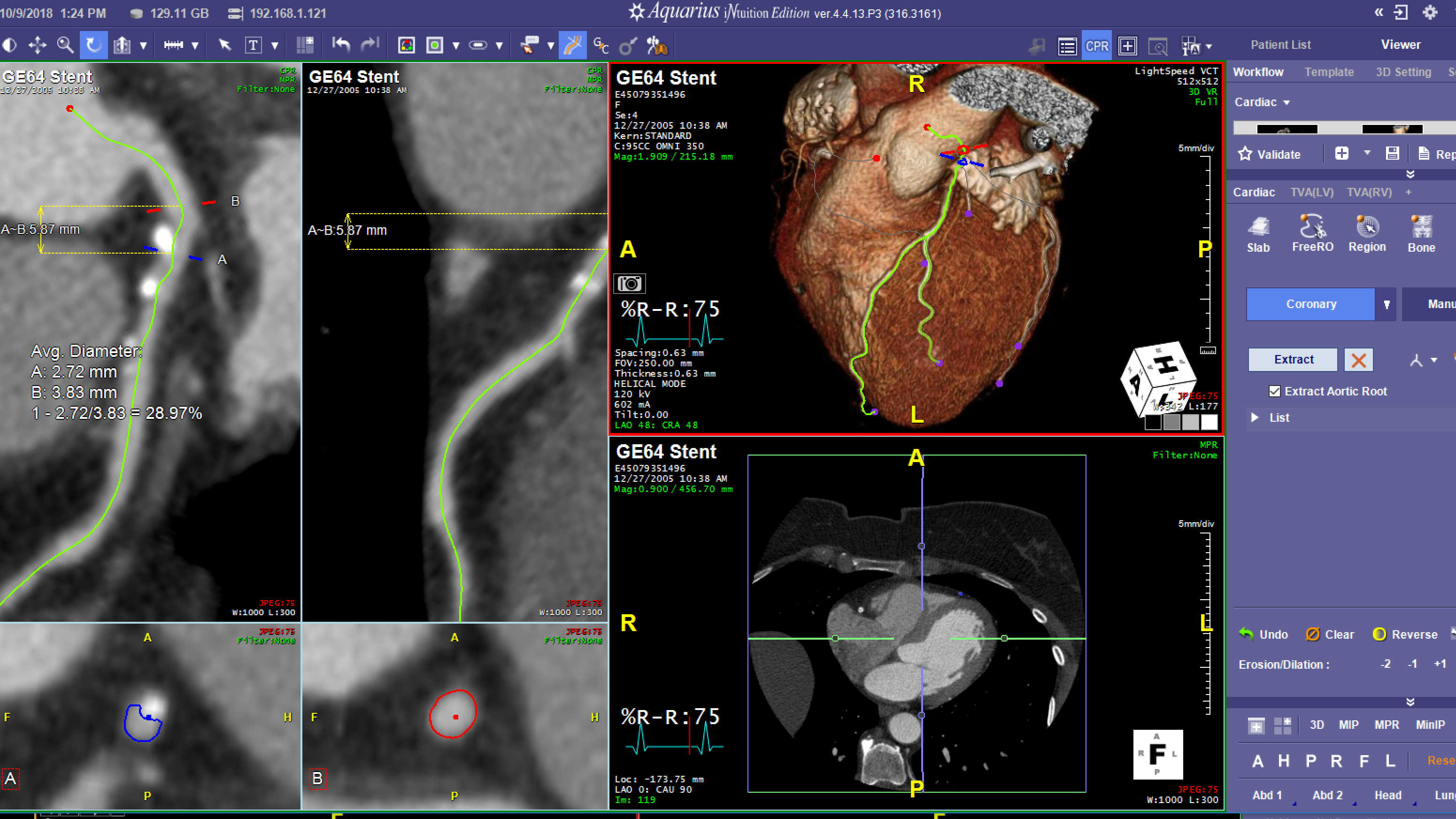 cardiac centerlines-798091-edited