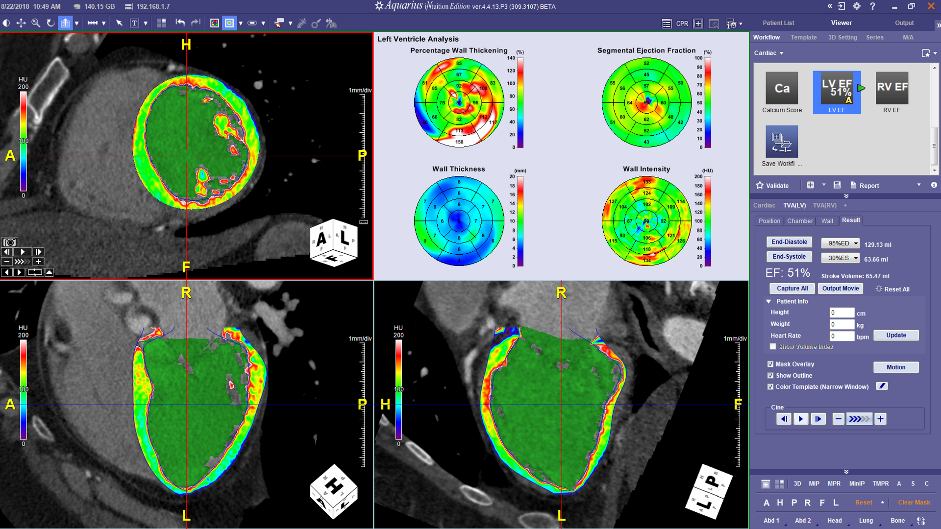 ct cardiac