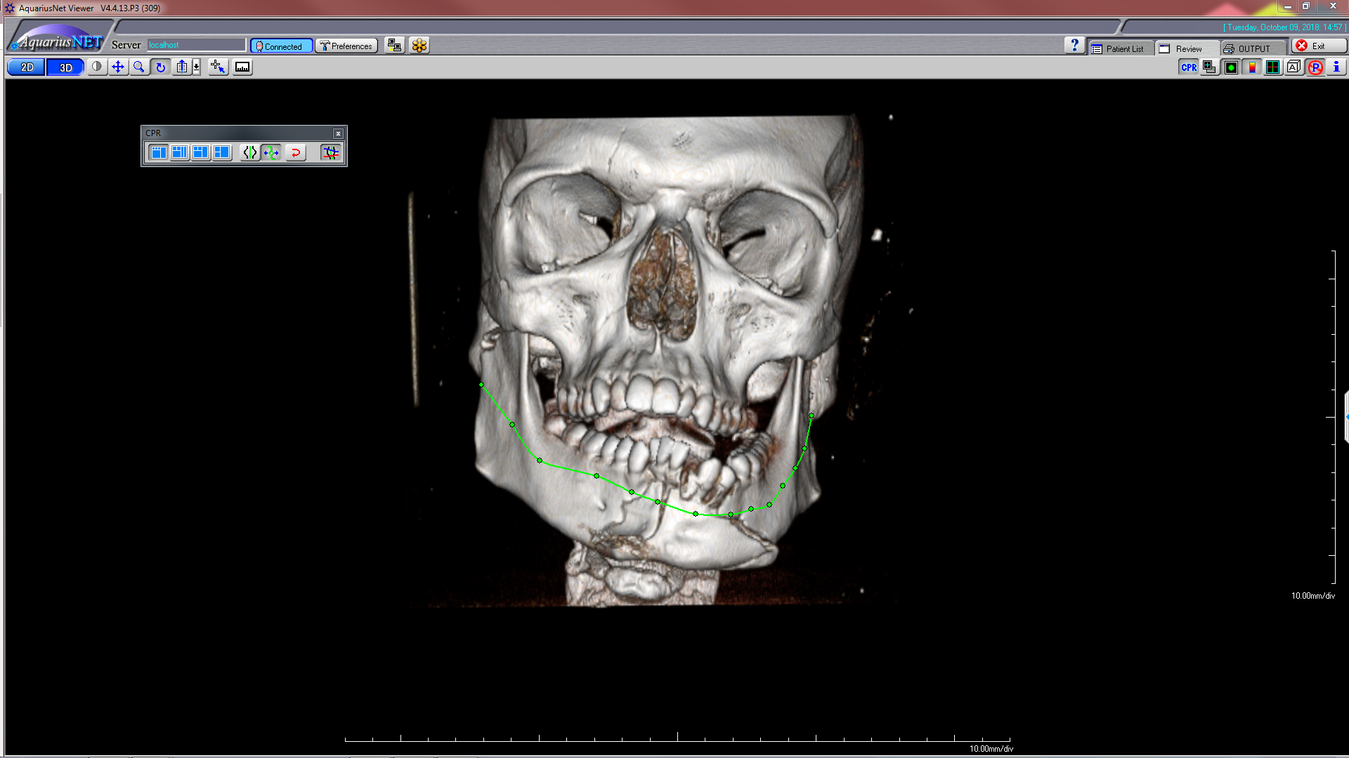 definable mandibular groove path-710996-edited (1)