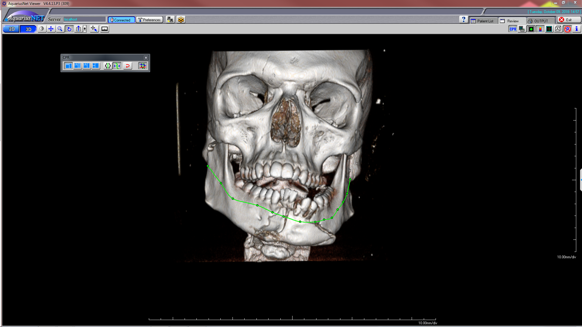 definable mandibular groove path-710996-edited