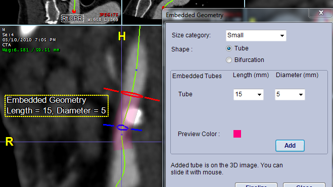 interventional embedded geometry-986091-edited