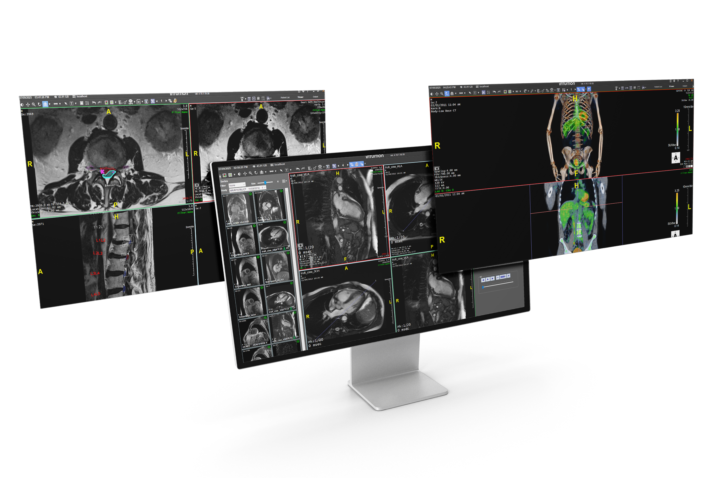 Intuition Mockup ALL-1