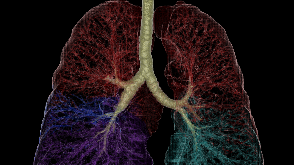 Lung and Lesion Segmentation