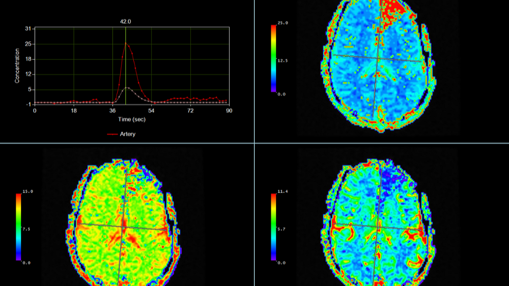 Time Dependent Analysis of Brain