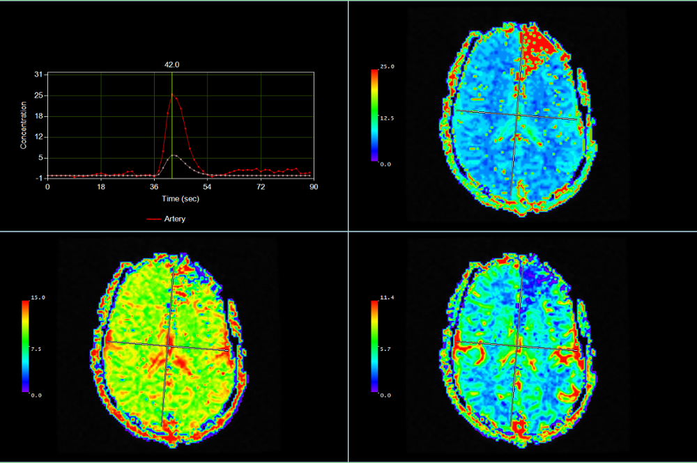 MR brain-2-1