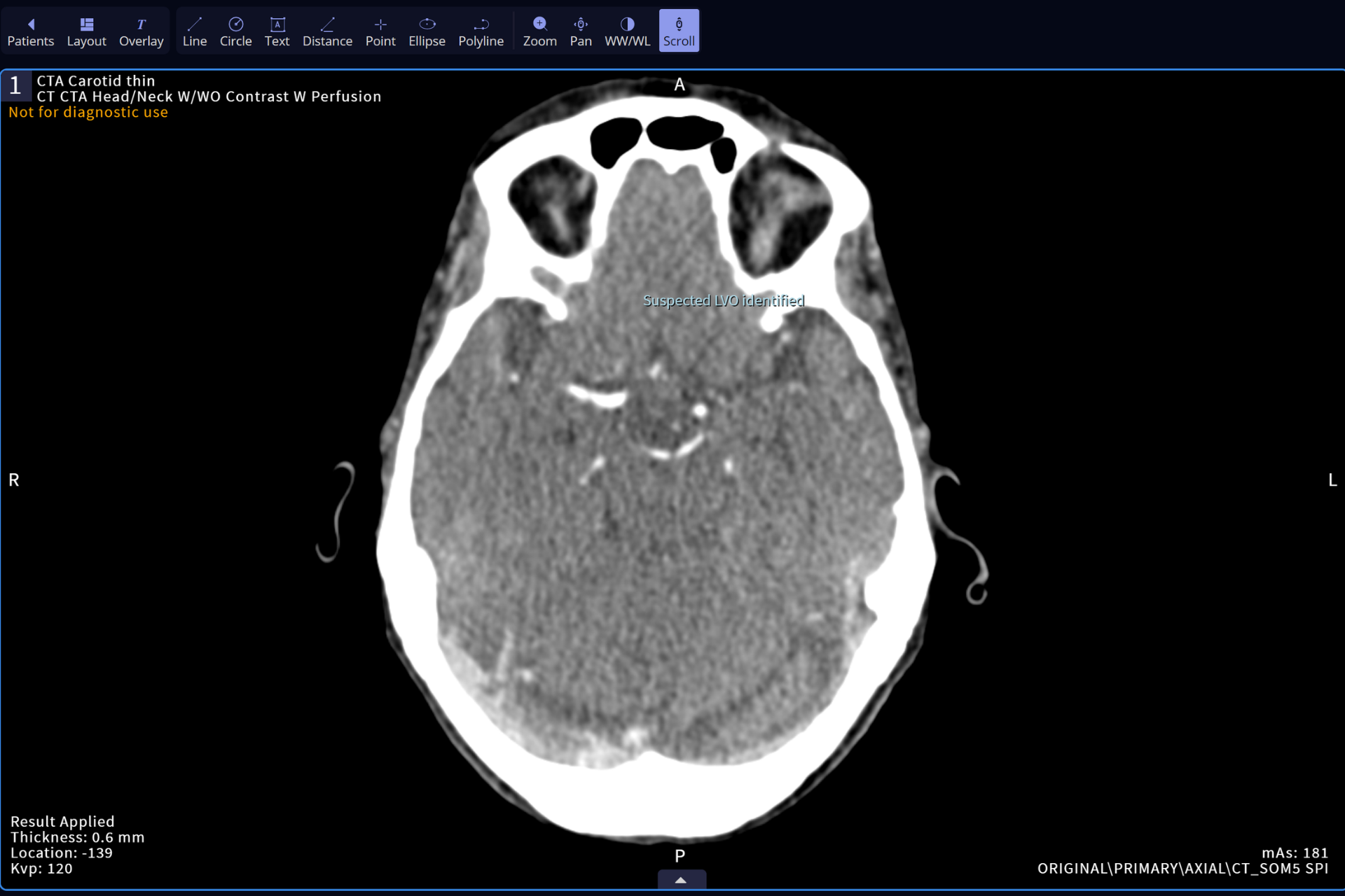 Neuro Assess CSW Web Images for Slider (1)