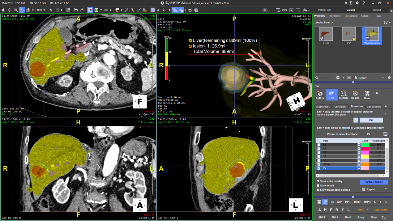 Lesion Analysis with Configurable Margins