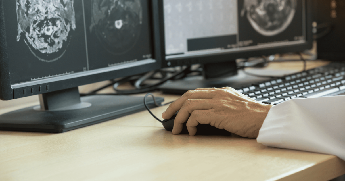 Radiologists' Trust of AI is Critical for Hospital Adoption