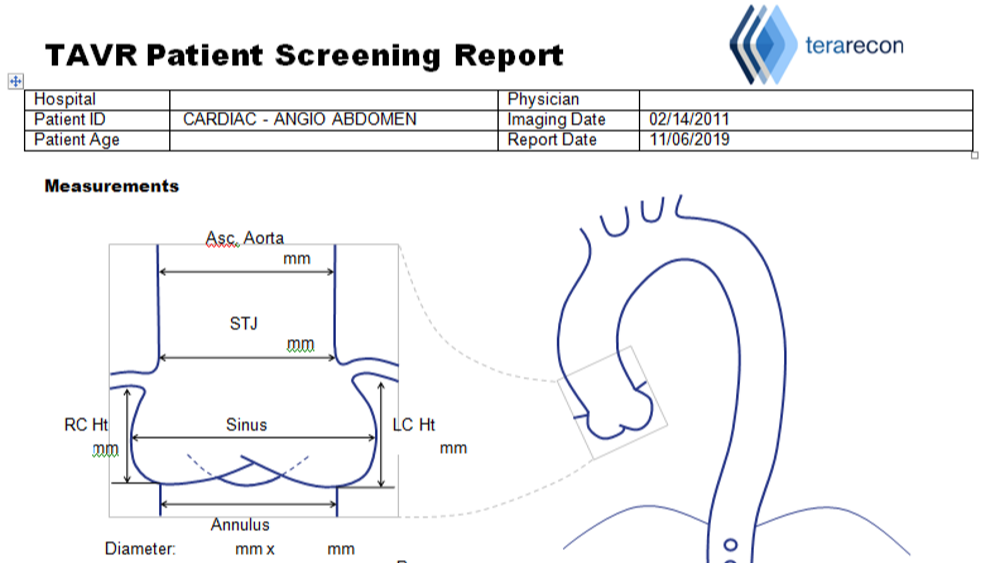 Report Tools