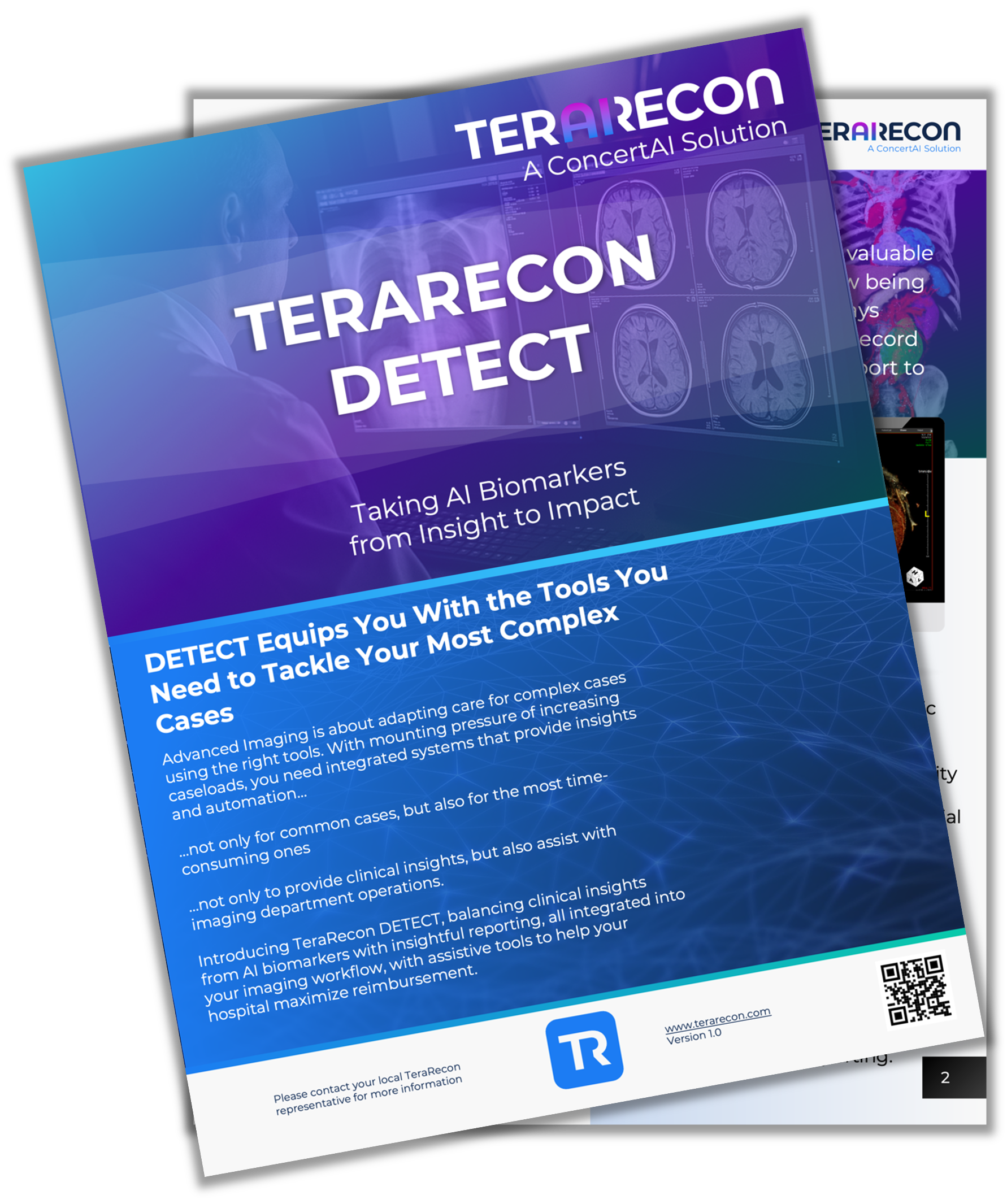TR Detect Brochure Mockup