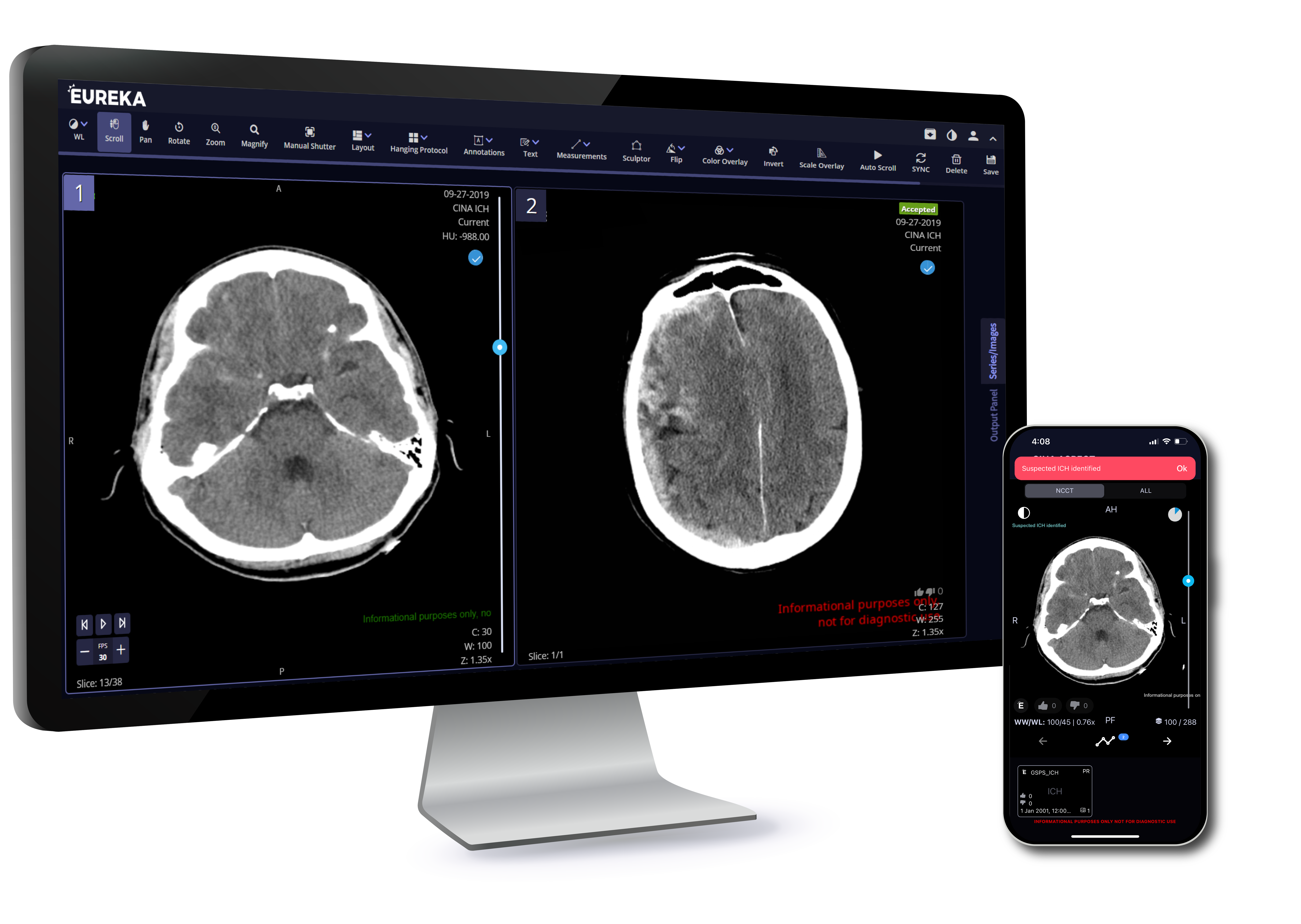 TeraRecon Neuro_ICH Desktop and Mobile