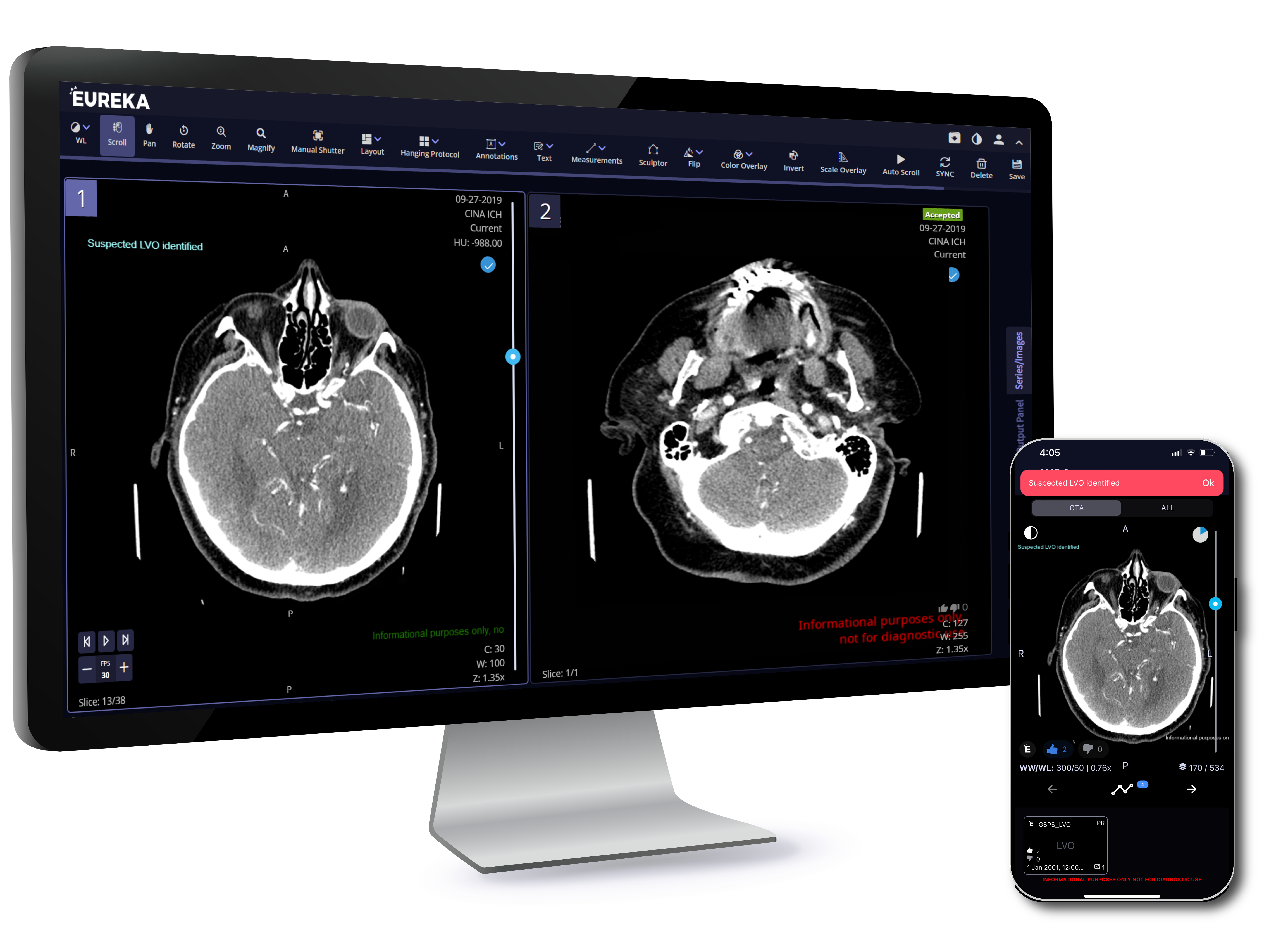 TeraRecon Neuro_LVO Desktop and Mobile