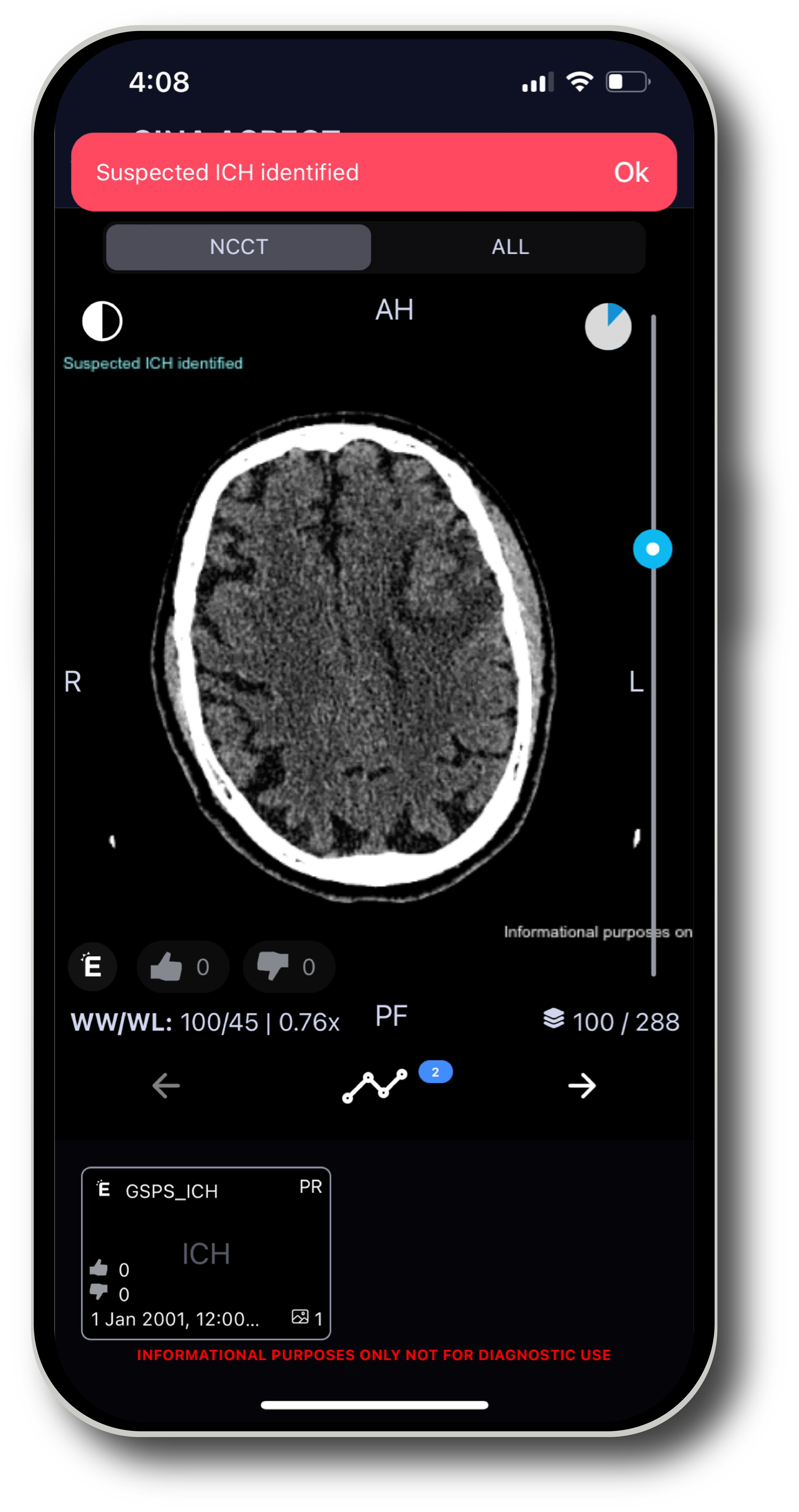 TeraRecon TR Neuro -Hero-Neuro-Mobile-ICH@4x