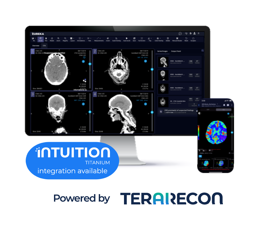 TR-Neuro-2.2-Solution-Page-AutomatedCTP-Tab-1