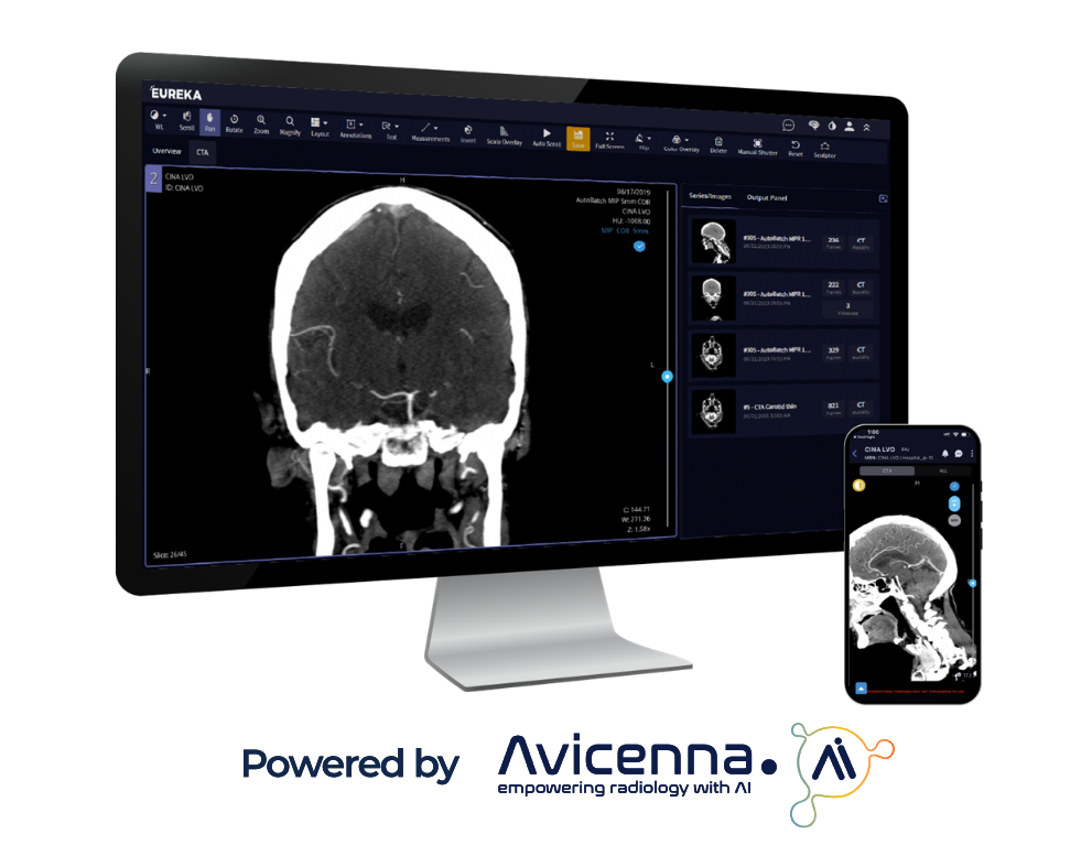 TRNeuro-2.2-LVO-Desktop-and-Mobile