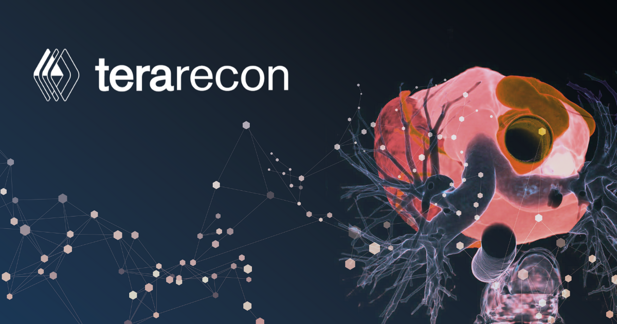 TeraRecon Awarded Two AI Platform Patents