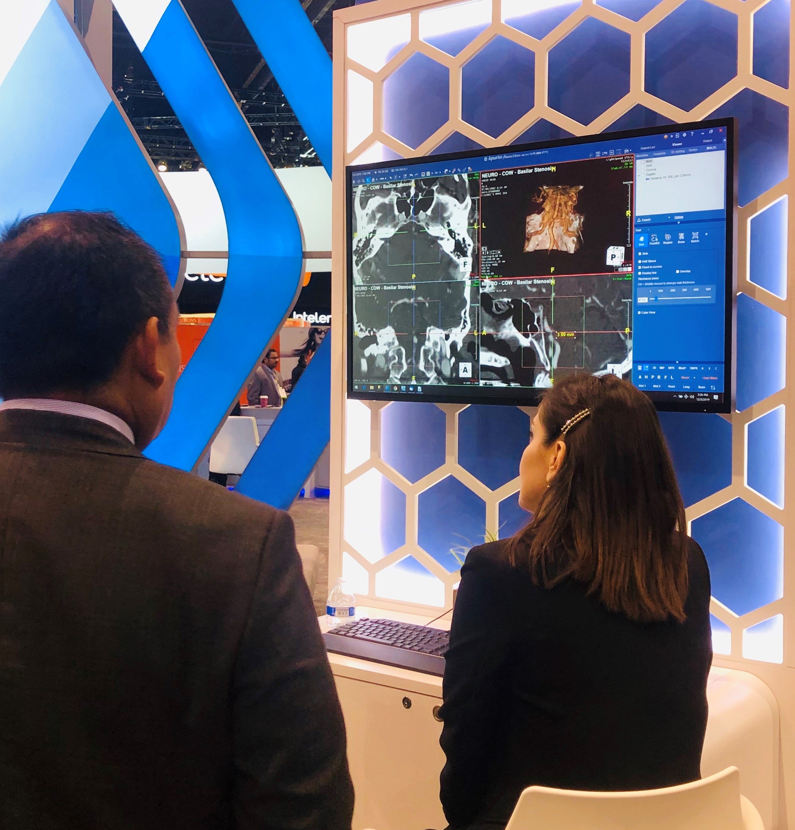 TeraRecon Body Region Demo at RSNA19 (2)