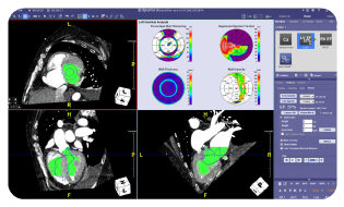 TeraRecon---Advanced-Visualizations-Page---Screen1