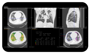 TeraRecon---Advanced-Visualizations-Page---Screen2