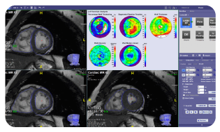 TeraRecon---Advanced-Visualizations-Page---Screen3