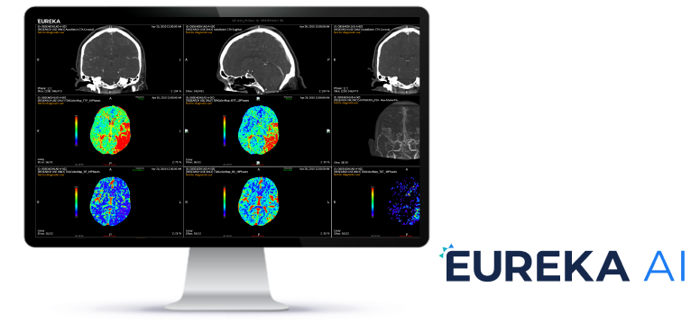 TeraRecon---Artificial-Intelligence-Page---Hero_Mockup