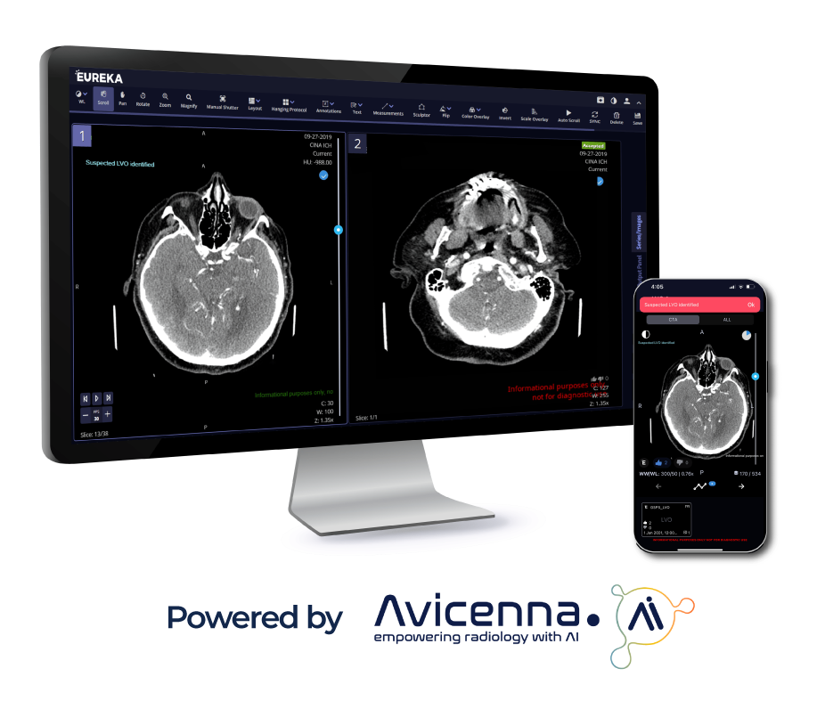 TeraRecon-Neuro_LVO-Desktop-and-Mobile